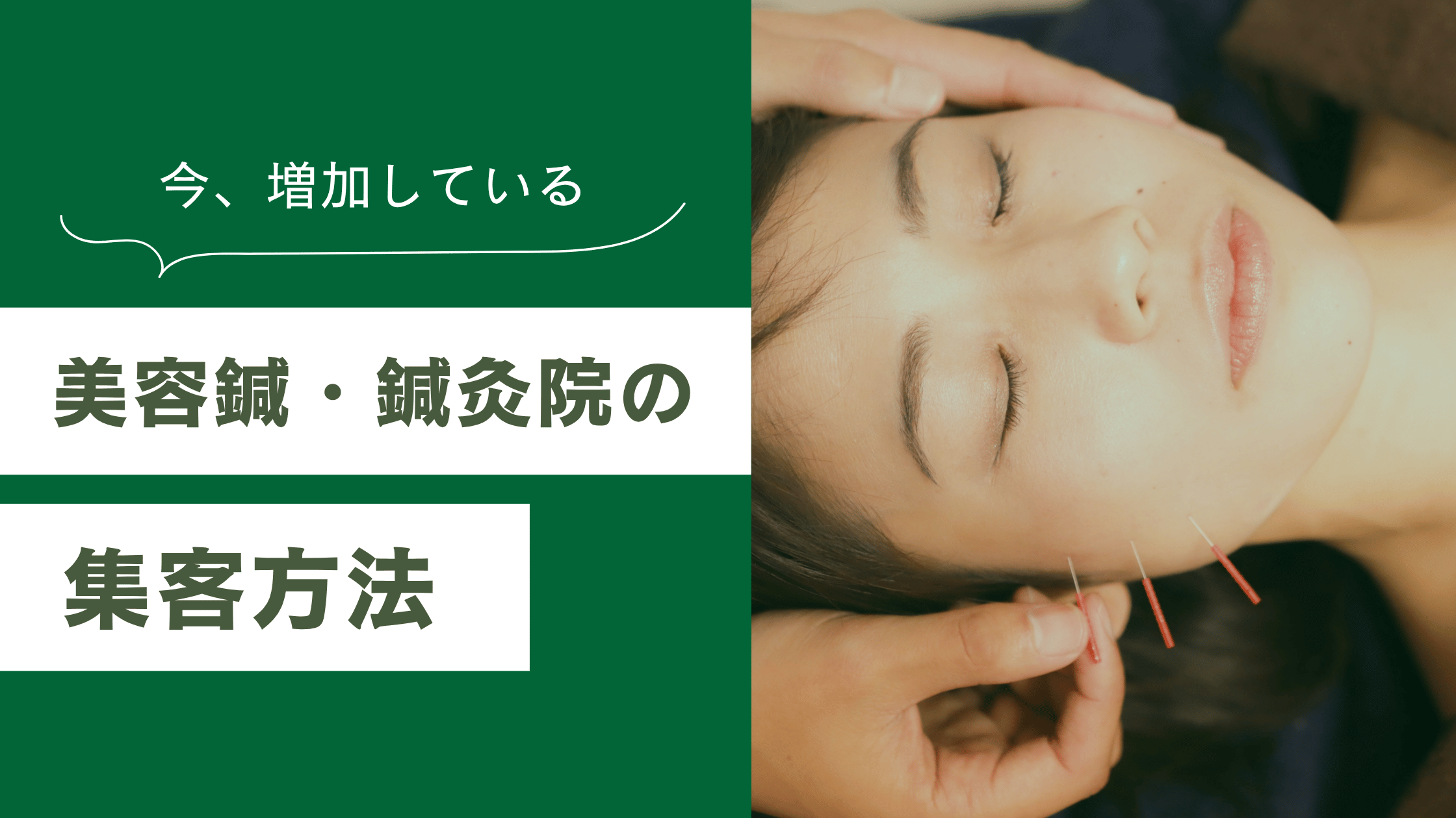 美容鍼の集客方法9選 | 新規集客&リピート獲得を解説